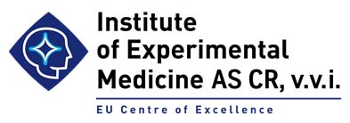 UEM